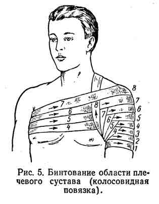 накладення пов'язок