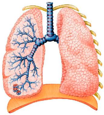 Medicina tradițională - pneumonie (pneumonie)