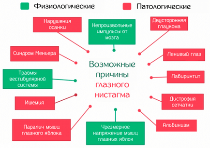 Ністагм очного яблука що це, причини виникнення спонтанного, вродженого, роторного,