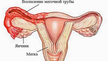 Рясні (сильні) виділення у жінок причини, норма і патологія
