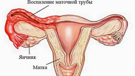 Depresuri abundente (puternice) la femei, norme și patologie