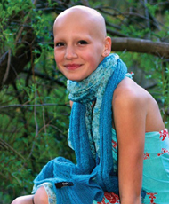 Alopecia focală a cauzei și opțiunile de tratament pentru alopecia focală