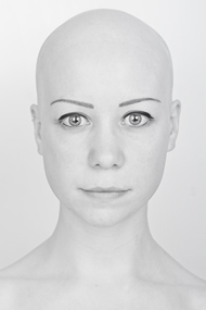 Alopecia areata okok és kezelési lehetőségek alopecia areata