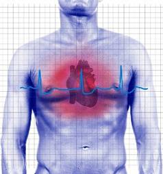 Periculos pentru extrasistole - tratament cardiac