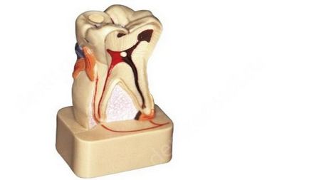 Pericolul în timp nu este vindecarea parodontitei, ce este parodontita, forme și tipuri