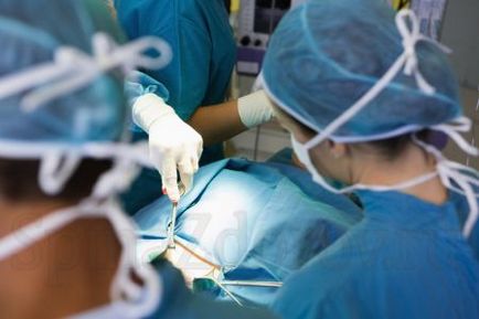 Операції при сподилолістезі новітні методи хірургічного лікування