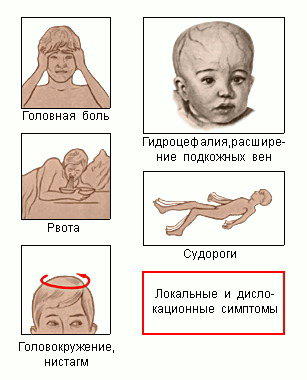 Пухлини головного мозку у дітей симптоми і ознаки