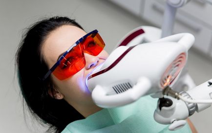 Відбілювання зубів системою beyond