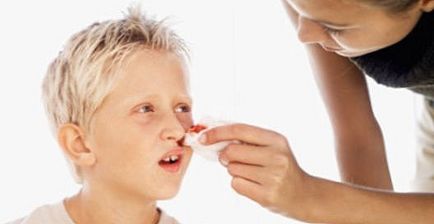 Fractura nasului în semnele copilului, simptome, tratament