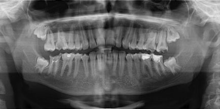 Prima consultare cu ortodontul și ce trebuie să știți despre contractul de tratament
