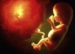 Placenta cu calcificări în săptămâna 37