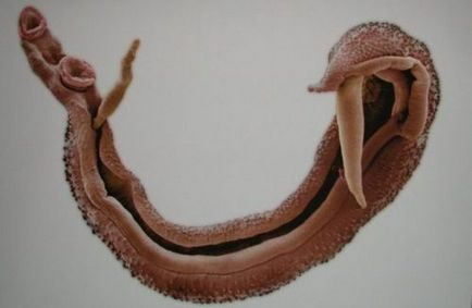 Плоскі черви паразити людини