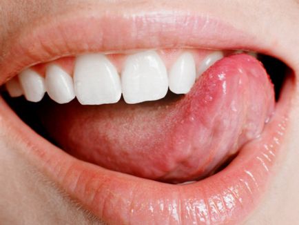 Semne ale bolii prin apariția limbii