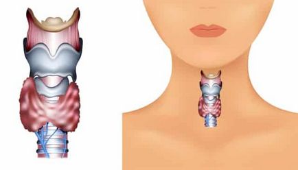 Tiroidian cancer - simptome, semne, etape, diagnostic și tratament