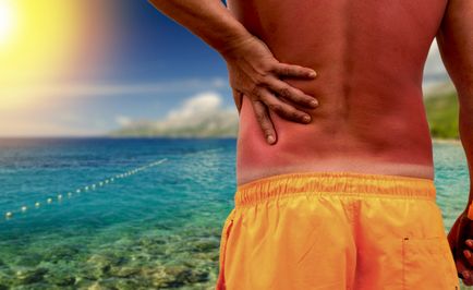 Сонячний опік як захистити шкіру, вітапортал - здоров'я і медицина