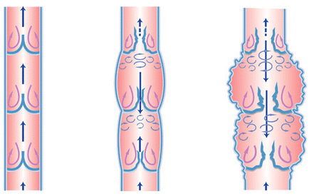 Clinica de chirurgie vasculară 