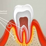 Clinica stomatologică în Mahacikala „Ortostom“ tratament stomatologic, un dentist bun