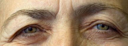Leziuni retinale - metode de diagnostic și tratament pe site-ul nostru!
