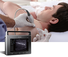 Diagnosticul ultrasonic al pancreatitei acute si a complicatiilor sale - mogota m