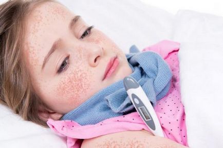 Copilul are o durere în gât și febră - semne ale bolii și ajutorul necesar