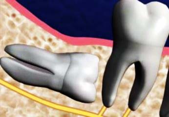 Chirurgie stomatologie articol știri video - ohi-s