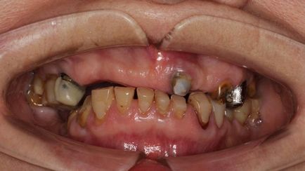 Chirurgie - știri și articole despre stomatologie - un portal dentar profesional (site)
