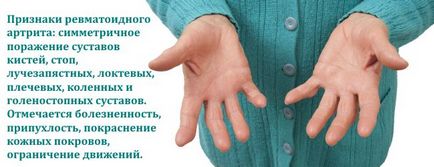 Захворювання кісток і суглобів