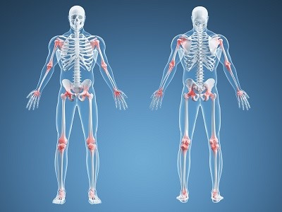 Захворювання кісток і суглобів