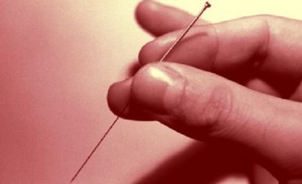 Acupunctura, eficacitatea și tratamentul acupuncturii