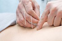 Acupunctura - o metoda eficienta de tratare a pierderii auzului - clinica de medicina tibetana 