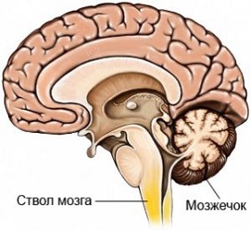 Алкогольна мозочкова дегенерація, лікування, наслідки