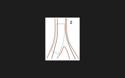 Bifurcație tehnician de examinare stenting, doc2doc