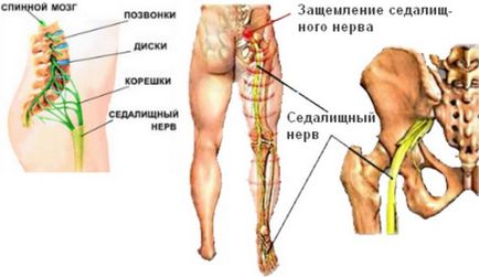 Болить горло як лікувати в домашніх умовах - як вилікувати горло в домашніх умовах