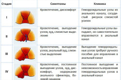 Болить поперек ночами