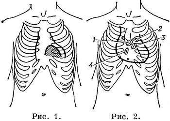 Фізичні методи дослідження серця огляд пальпація перкусія визначенні розмірів