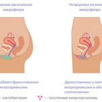 Прапори (свічки, таблетки) інструкція із застосування, ціна, відгуки та аналоги