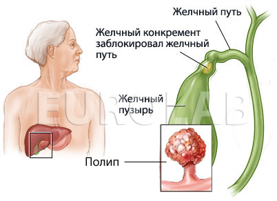 Revederea hepatoprotectorilor pentru toate medicamentele pentru ficat, ABC pentru sănătate, medicamente pentru ficat biliar