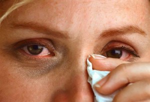 Ciuperca din jurul ochilor provoacă, simptome și metode de tratament