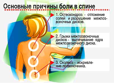 Йога для лікування болю в спині і попереку