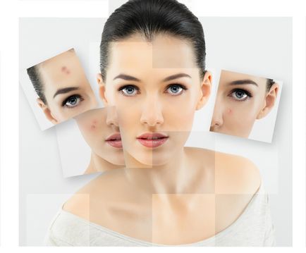 Як відбілити шкіру обличчя в домашніх умовах жіноче здоров'я