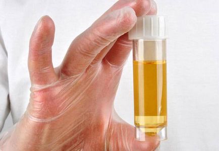 Cum să vindeci urina bolii ENT, un vechi veac