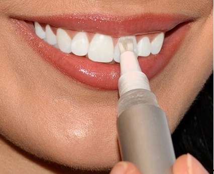 Ceruza fényes fehér fogak visszajelzést, használati, hol vesz egy ceruza fényes fehér fogak, mintegy