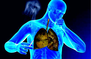 Tusea fumător - cauze și simptome