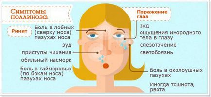 Tuse cu febra fânului sau febra fânului, simptome și tratament, nas nazal sezonier la copii și adulți