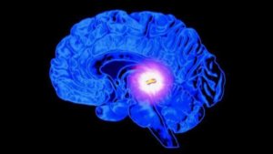 Cyst átlátszó agy septum kezelés, specifitás és a nem sebészi radikális
