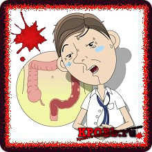 Sângerarea la polipi - tratamentul sângerării