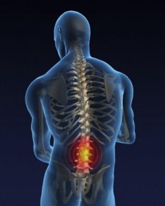 Exerciții terapeutice pentru osteocondroza lombară, cauze, semne, recomandări și sfaturi
