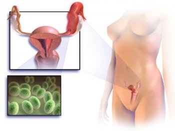 Tratamentul hiperplaziei endometriale, simptome și cauze