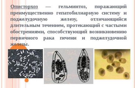 Tratamentul remediilor folclorice opisthorchiasis 15 retete eficiente pentru combaterea parazitilor