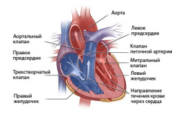 Tratamentul defectelor cardiace